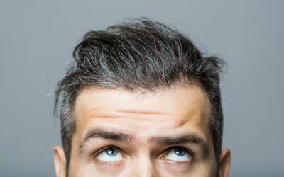 What is a Follicular Unit Excision Hair Transplant?