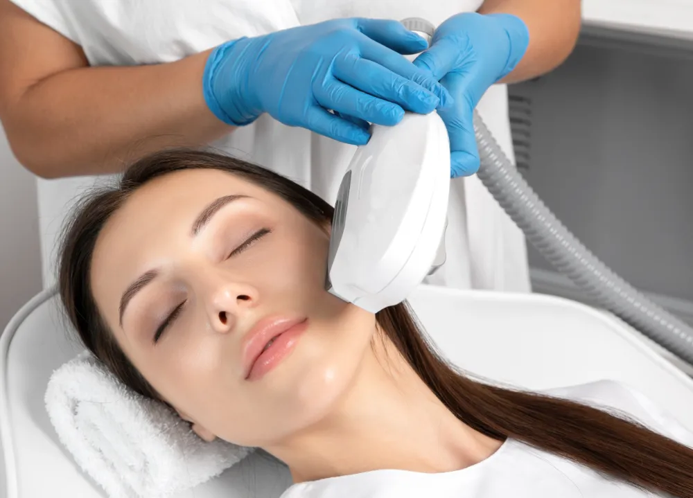 Elos epilation hair removal procedure on the face of a woman