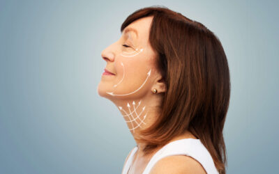 Out With the Old, In With the New: Your Quick Guide to Getting a Facelift