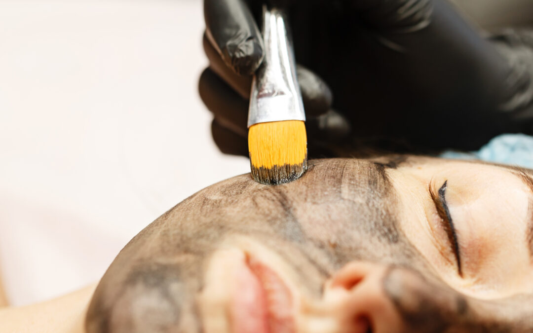 new year new skin with nano laser peel frisco